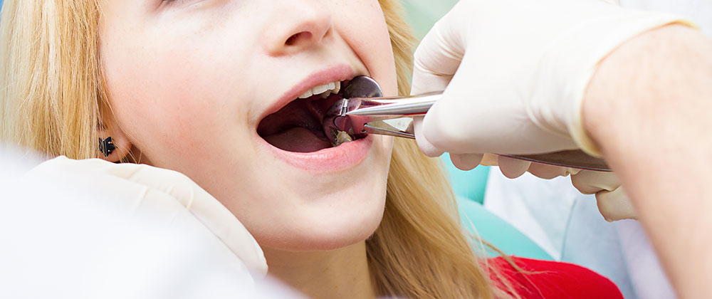 Florida Tooth Extraction Lawyer